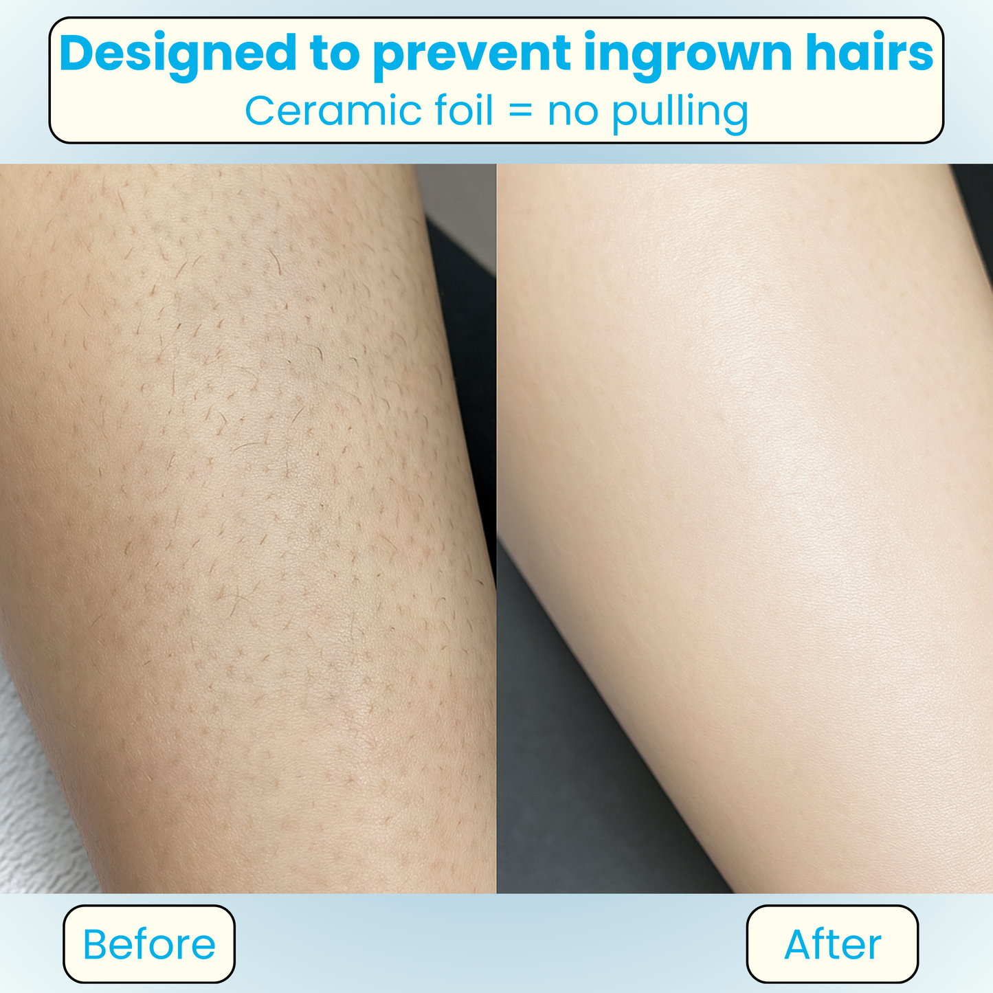 Vivaria Breeze Dual Trim