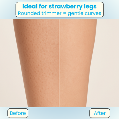 Vivaria Breeze Dual Trim