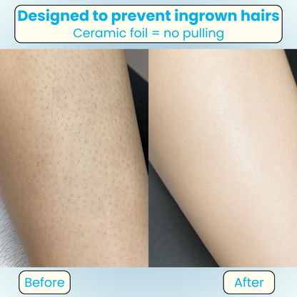 Vivaria Breeze Dual Trim